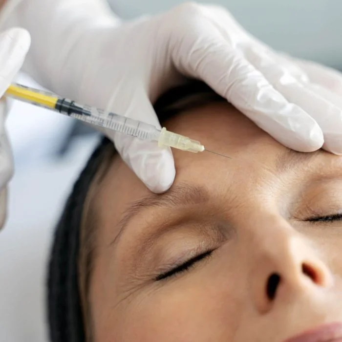 close-up-view-of-the-cosmetologist-does-prp-therap-2022-11-29-21-01-48-utc2 (1)