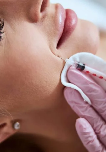 female-doctor-reducing-the-appearance-of-the-nasol-2021-09-03-09-46-28-utc0 (1)